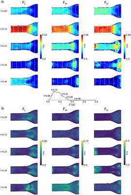 A hybrid mock circulatory loop integrated with a LED-PIV system for the investigation of AAA compliant phantoms